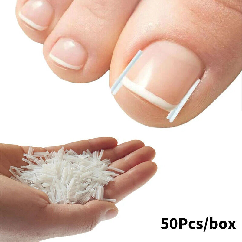 50-100 Pcs Ingrown Toenail Corrector Toe Foot Nail Correction Sticker Pedicure - Picture 11 of 12
