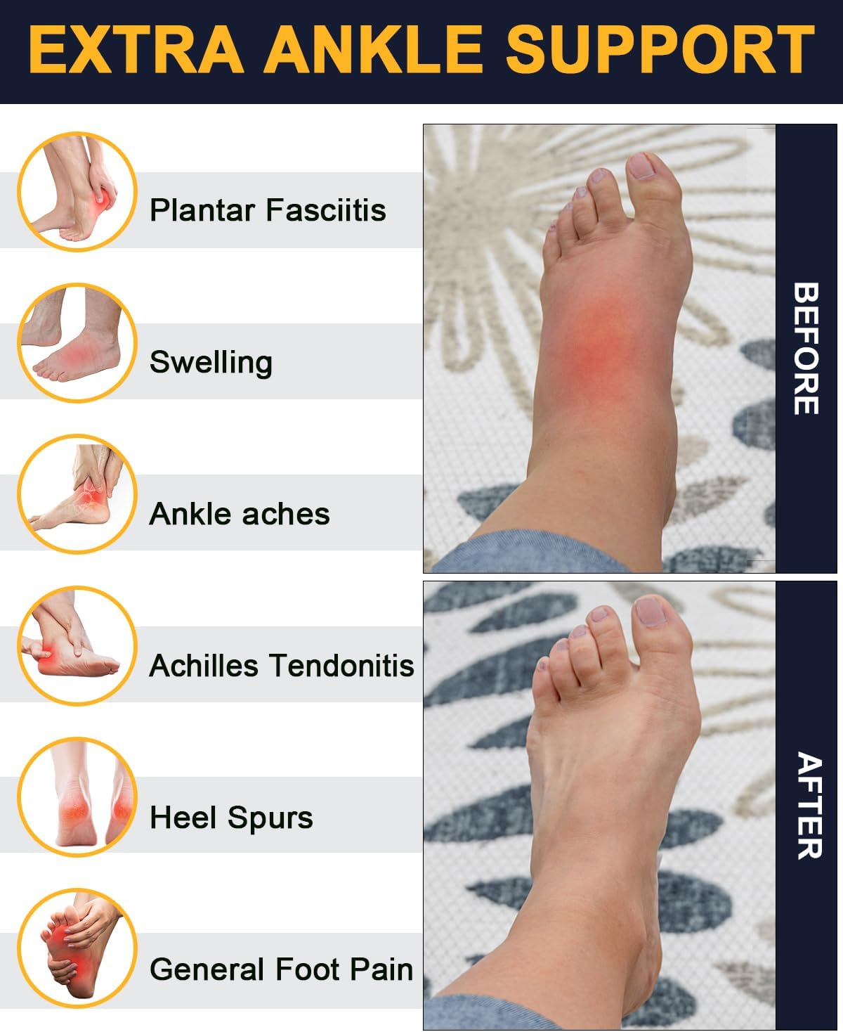 5 Pairs Copper Compression Socks �C Ankle, Plantar Fasciitis & Arch Support - Picture 48 of 105